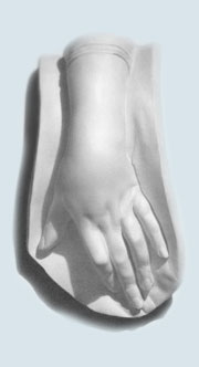 Plaster Cast Arm
